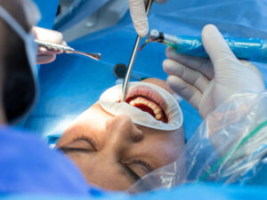 cirurgia oral