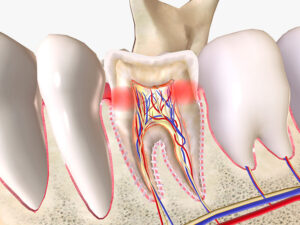 endodontia
