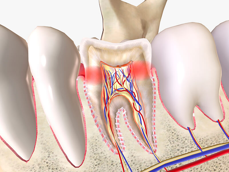 endodontia