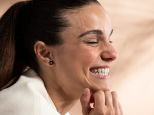 Lentes de contato dental